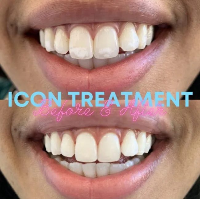 Icon Spot Treatment