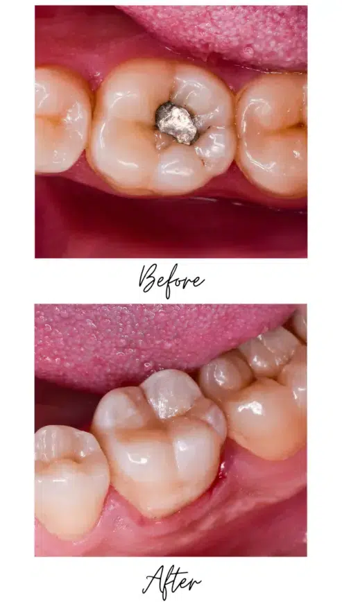 Holistic Dentist Toronto