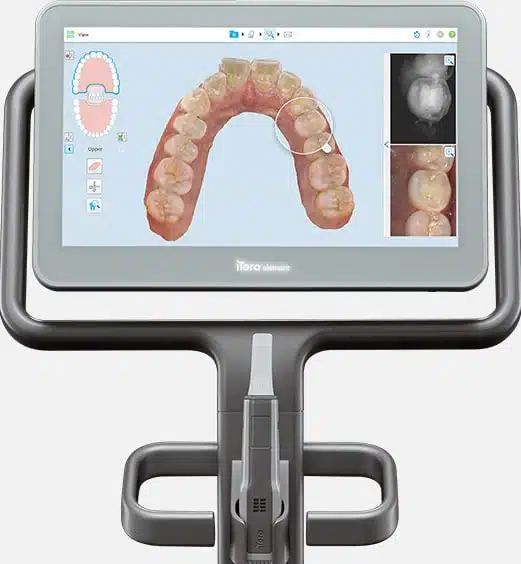 Invisalign Toronto itero