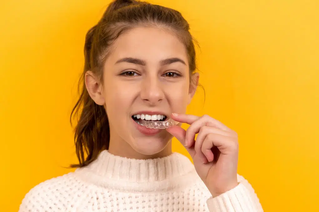 Invisalign in Toronto: Can Invisalign Fix Underbite or Overbite?