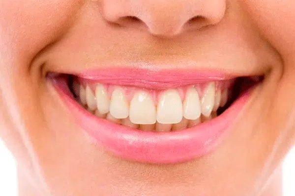 Professional Teeth Whitening in Toronto 2