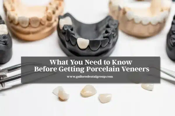 What-You-Need-to-Know-Before-Getting-Porcelain-Veneers