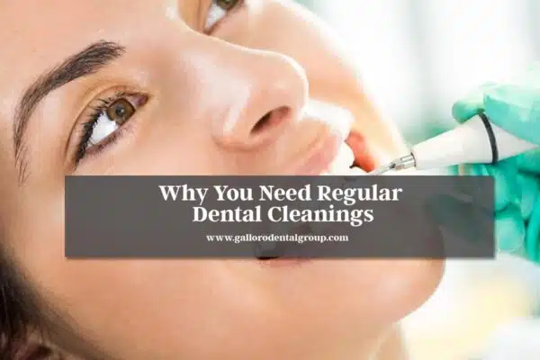 Why-You-Need-Regular-Dental-Cleanings