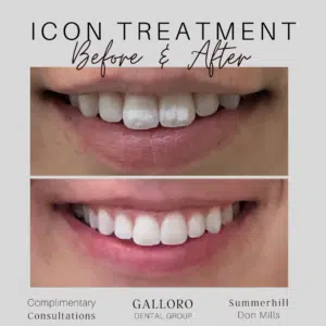 Icon Treatment Toronto Summer Hill and Don Mills