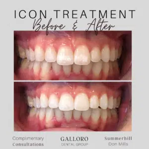 Icon Treatment Toronto Summer Hill and Don Mills